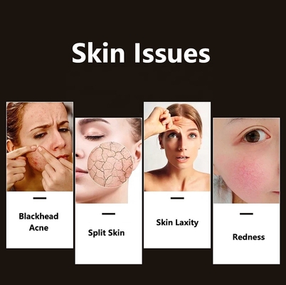 Compact Skin Led Facial Light Therapy for Acne Improvement Professional Grade