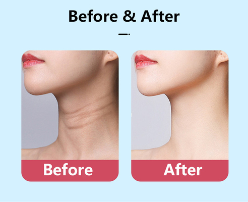 Facial Microcurrent EMS Neck Face Lifting Massager Multi-function Beauty Eqiupment