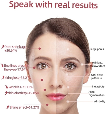 EMS Vibrating Face Beauty Device for Wrinkle Removal and Anti-aging HAND HELD Design