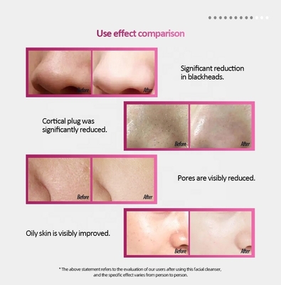 Shock Comfort USB Charging Silicone Clean Brush for Face Cleansing 3 Hours Charging Time