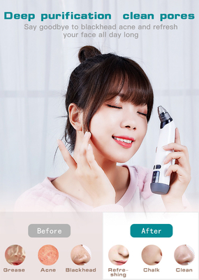 2023 Facial Blackhead Remover with USB Charge Plugs Type and Ultrasonic Skin Scrubber