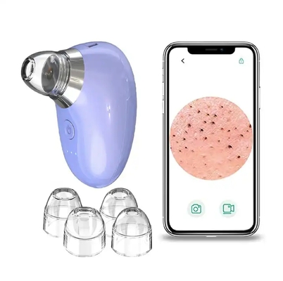 Facial Cleaner Blackhead Removal Tool with Camera Wi-Fi Mini Visible Vacuum in 2023