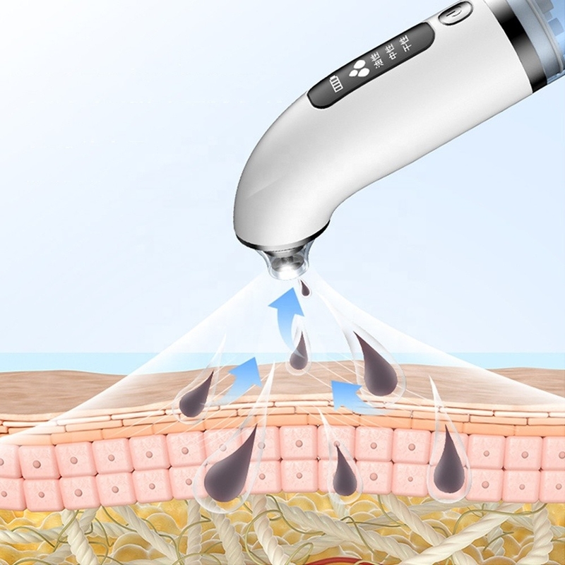 3 Gears Oxygen Injection Appliance for Effective Pore Cleansing and Blackhead Removal